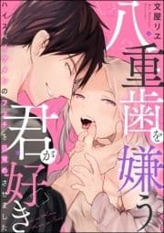 八重歯を嫌う君が好き ハイスペイケメンのフェチを目覚めさせました(単話版)_thumbnail